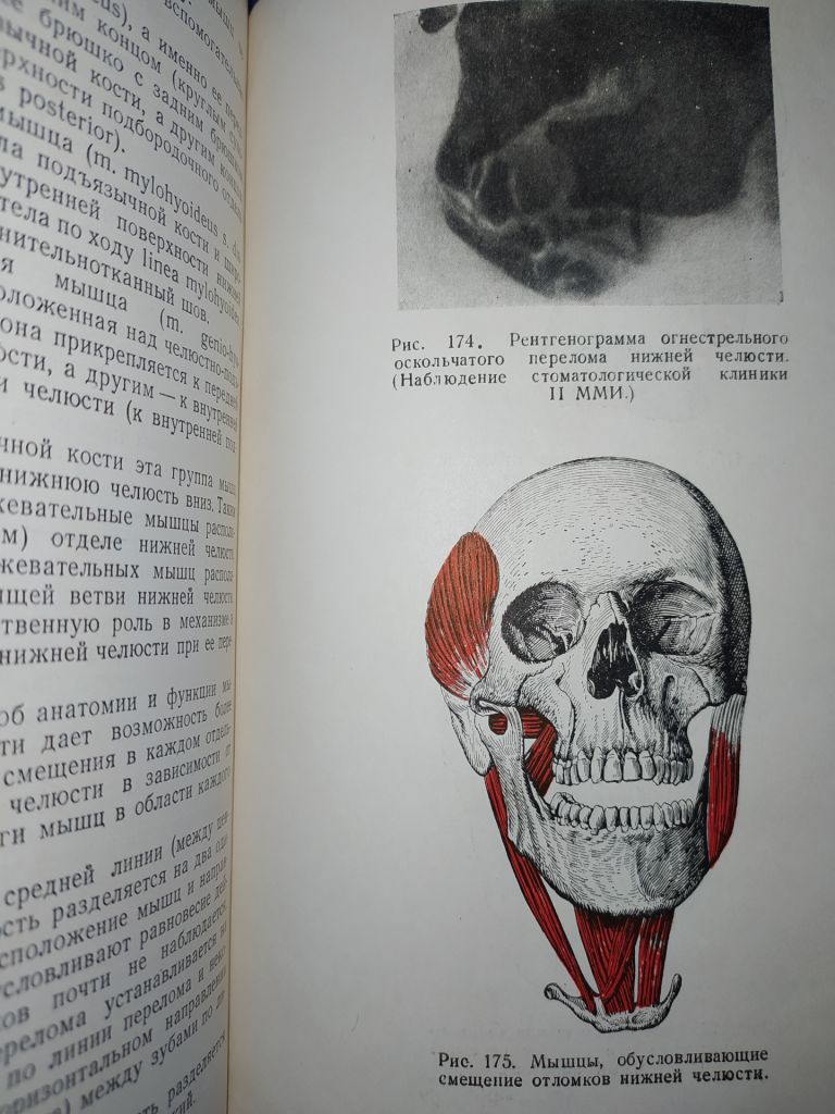 книга: СТОМАТОЛОГИЯ. II-е изд. авт.: И.М.Старобинский 1951г. - фото фото фото 9