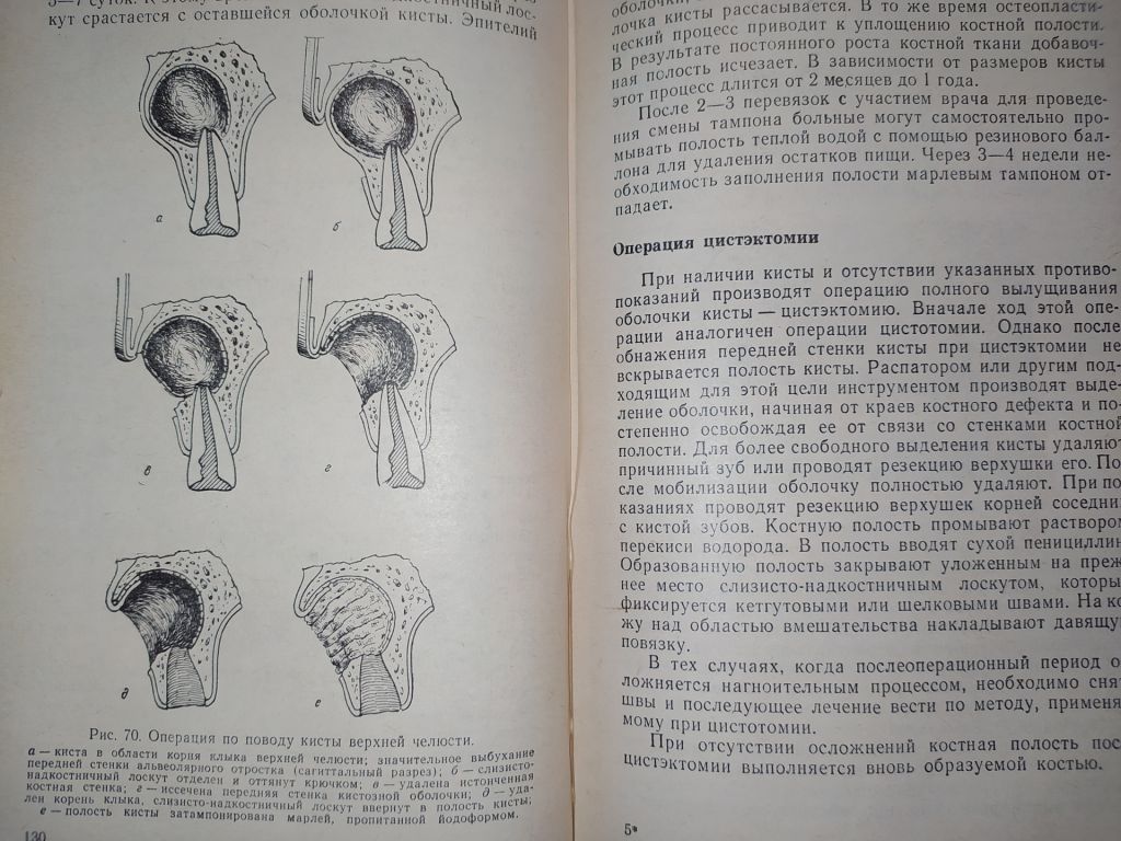 книга: СТОМАТОЛОГИЯ 1970г. - фото фото фото 8
