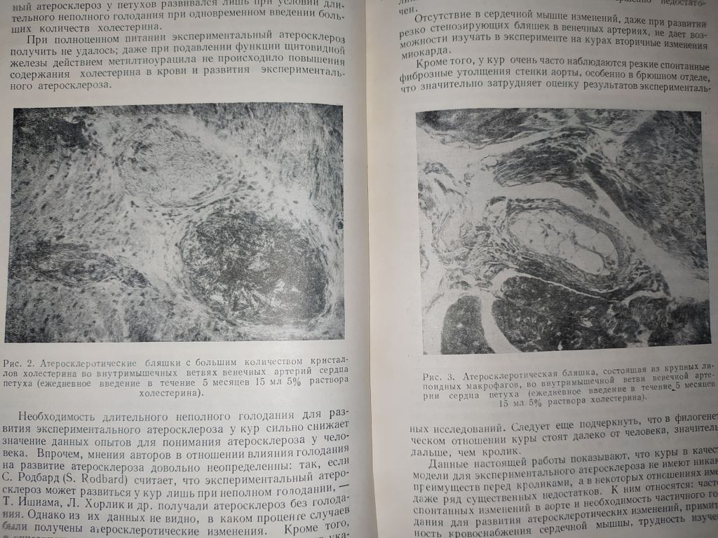 книга: АТЕРОСКЛЕРОЗ И КОРОНАРНАЯ НЕДОСТАТОЧНОСТЬ 1956г. - фото фото фото 5