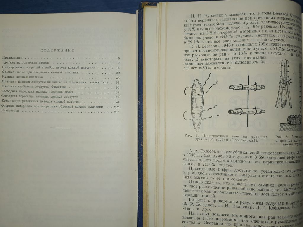 книги Проф. Н.Н.Блохина: КОЖНАЯ ПЛАСТИКА 1955г. - фото фото фото 2