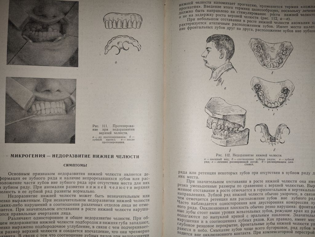 книга: УЧЕБНИК ОРТОПЕДИЧЕСКОЙ СТОМАТОЛОГИИ, II-е изд., 1962г. - фото фото фото 10