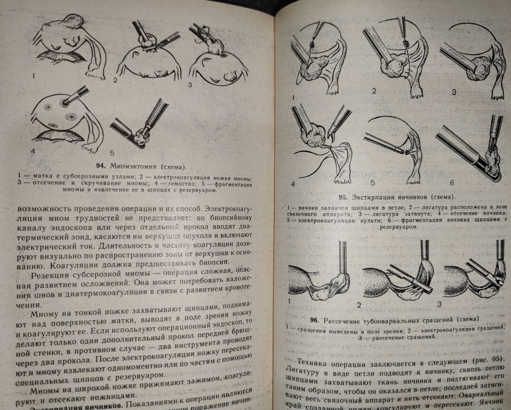 книга: ЭНДОСКОПИЯ 1987г. - фото фото фото 8