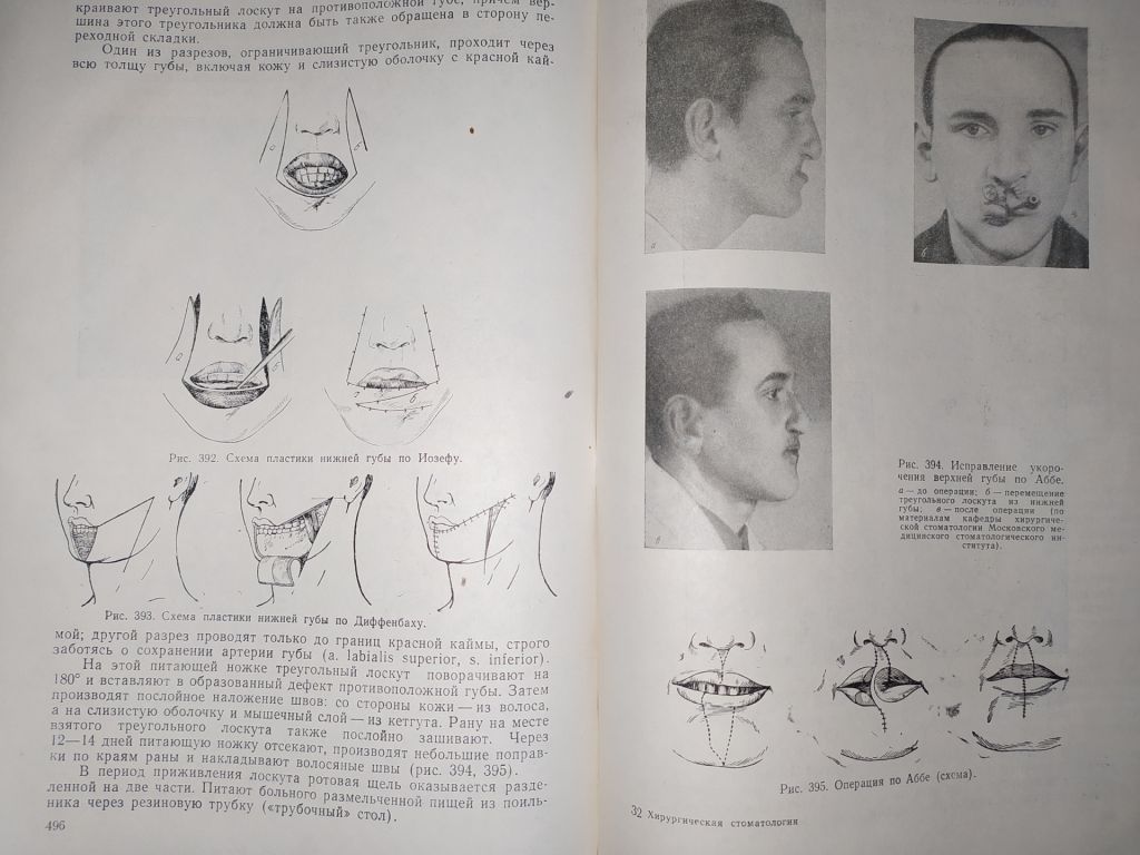 книга: ХИРУРГИЧЕСКАЯ СТОМАТОЛОГИЯ 1959г. - фото фото фото 6