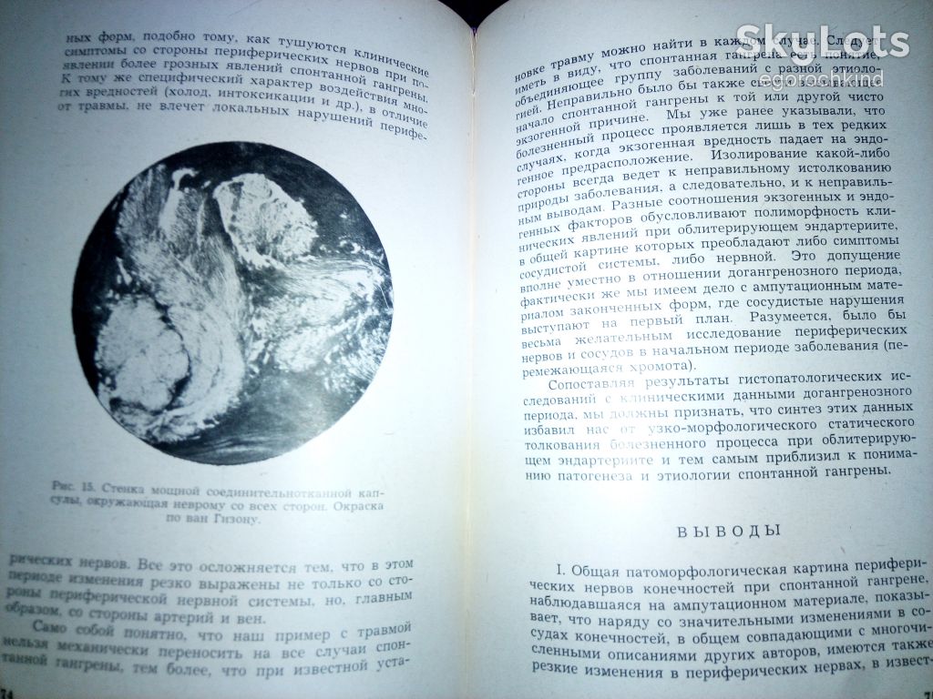 книга: ИШЕМИЧЕСКИЕ ЗАБОЛЕВАНИЯ НЕРВНЫХ СТВОЛОВ 1945г.; - фото фото фото 4