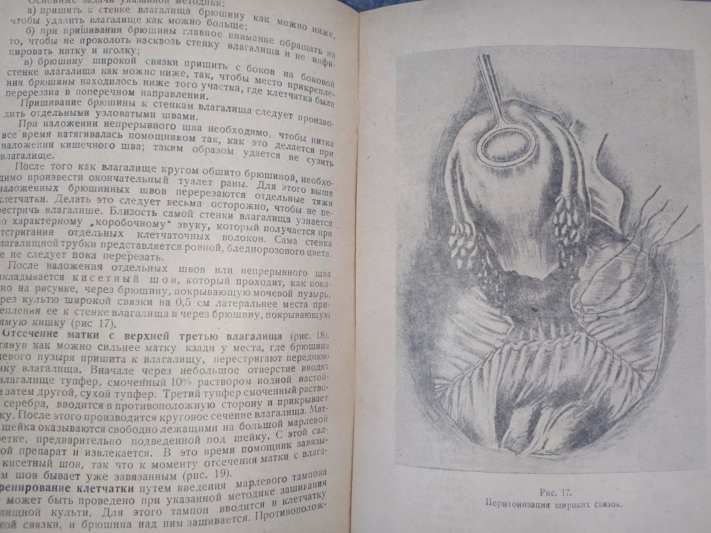 книга: ПРОФИЛАКТИКА, КЛИНИКА И ТЕРАПИЯ РАКА МАТКИ 1947г. - фото фото фото 8