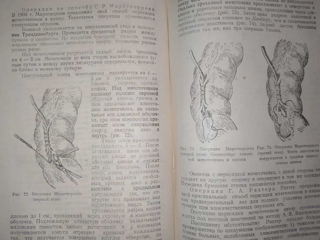 книга: ОЧЕРКИ ОПЕРАТИВНОЙ УРОЛОГИИ. II-e изд. 1959г. - фото фото фото 8