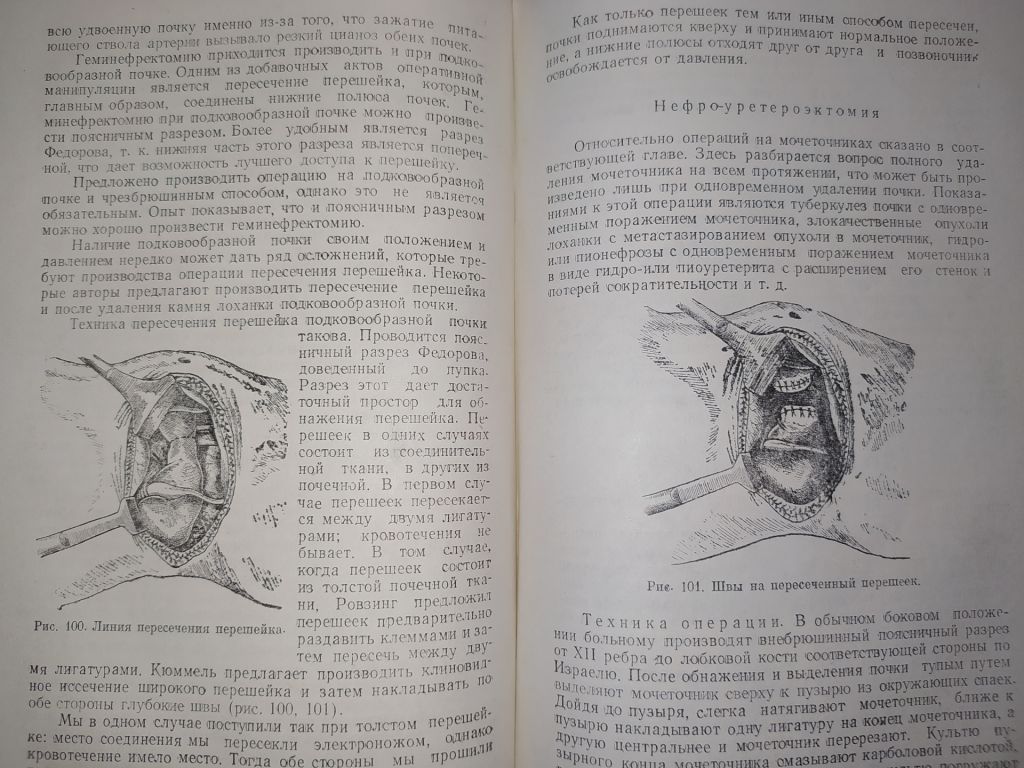 книга: ОЧЕРКИ ОПЕРАТИВНОЙ УРОЛОГИИ. II-e изд. 1959г. - фото фото фото 6