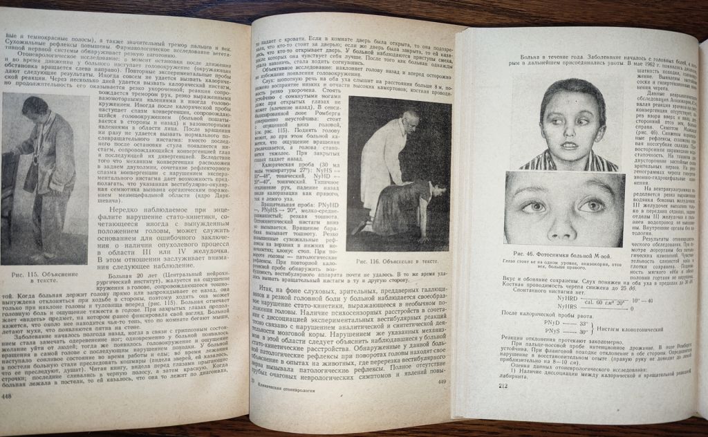 книги: КЛИНИЧЕСКАЯ ОТОНЕВРОЛОГИЯ 1952г. ЧАСТНАЯ ОТОНЕВРОЛОГИЯ 1966г.; - фото фото фото 8