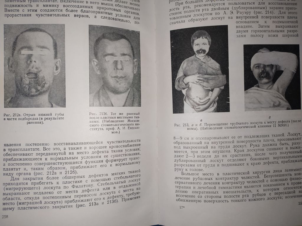 книга: СТОМАТОЛОГИЯ. II-е изд. авт.: И.М.Старобинский 1951г. - фото фото фото 6