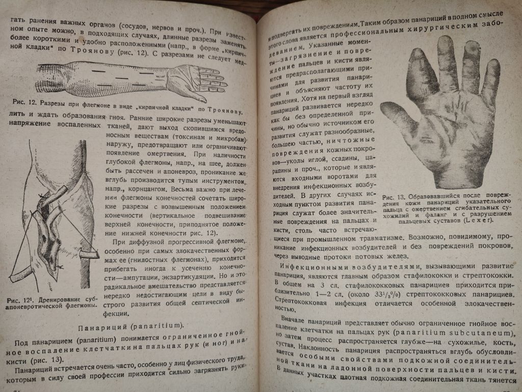 книга: ОСНОВЫ ОБЩЕЙ ХИРУРГИИ, том II, 1937г.; - фото фото фото 13