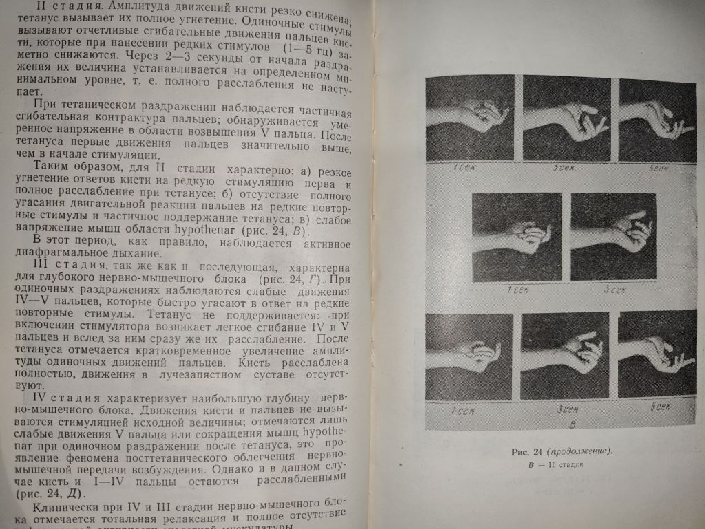 книга: МЫШЕЧНЫЕ РЕЛАКСАНТЫ В АНЕСТЕЗИОЛОГИИ 1970г. - фото фото фото 8