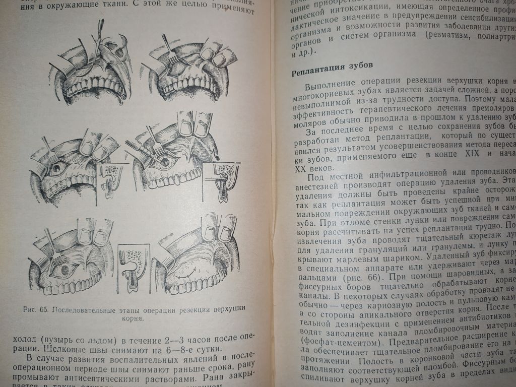 книга: СТОМАТОЛОГИЯ 1970г. - фото фото фото 9