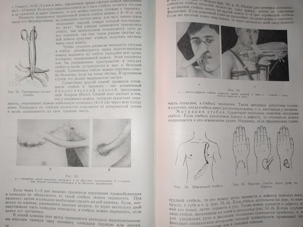 книга: ВОССТАНОВИТЕЛЬНЫЕ ОПЕРАЦИИ ЧЕЛЮСТНО-ЛИЦЕВОЙ ОБЛАСТИ 1962г. - фото фото фото 5