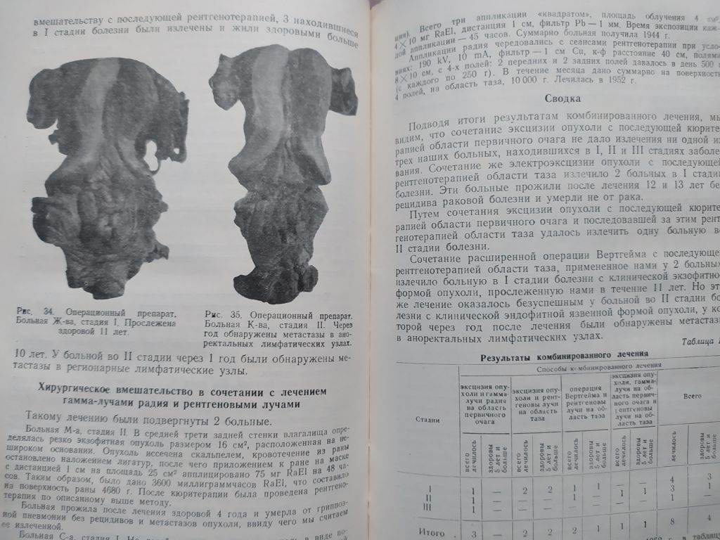 книга: РАК ВЛАГАЛИЩА. КЛИНИЧЕСКАЯ МОНОГРАФИЯ 1954г. - фото фото фото 5