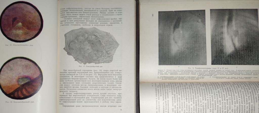 книга: НОВЫЕ МЕТОДЫ ДИАГНОСТИКИ В ОНКОЛОГИИ И РЕНТГЕНОЛОГИИ 1957г. - фото фото фото 3