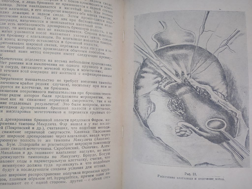 книга: ПРОФИЛАКТИКА, КЛИНИКА И ТЕРАПИЯ РАКА МАТКИ 1947г. - фото фото фото 7