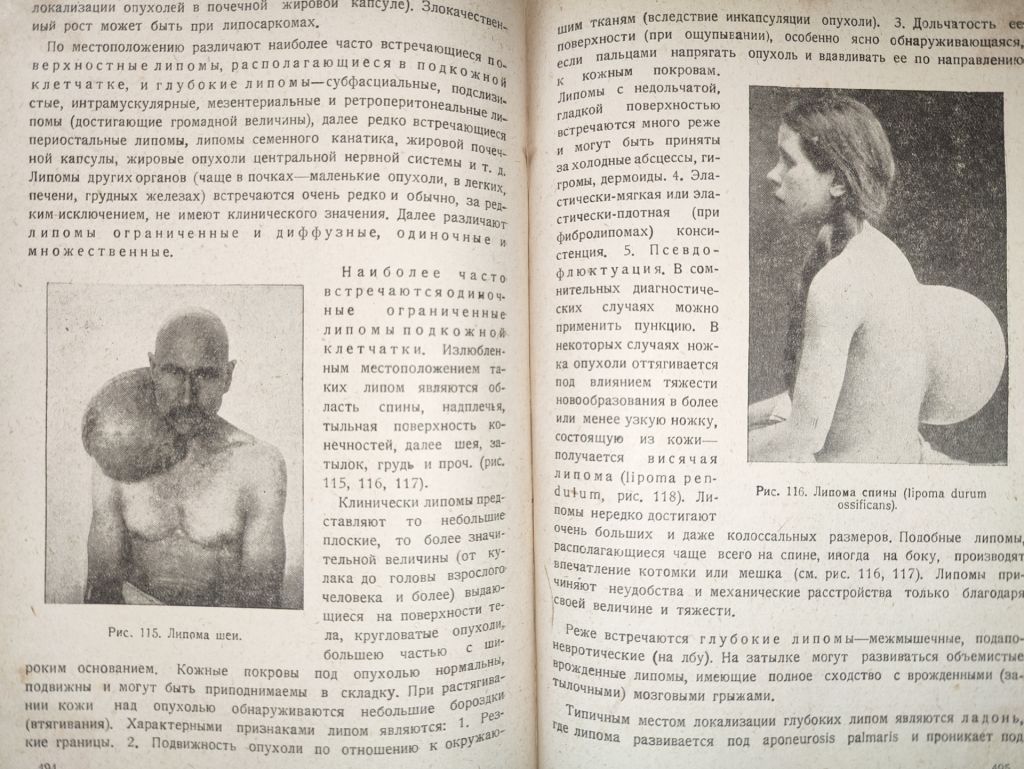 книга: ОСНОВЫ ОБЩЕЙ ХИРУРГИИ, том II, 1937г.; - фото фото фото 8