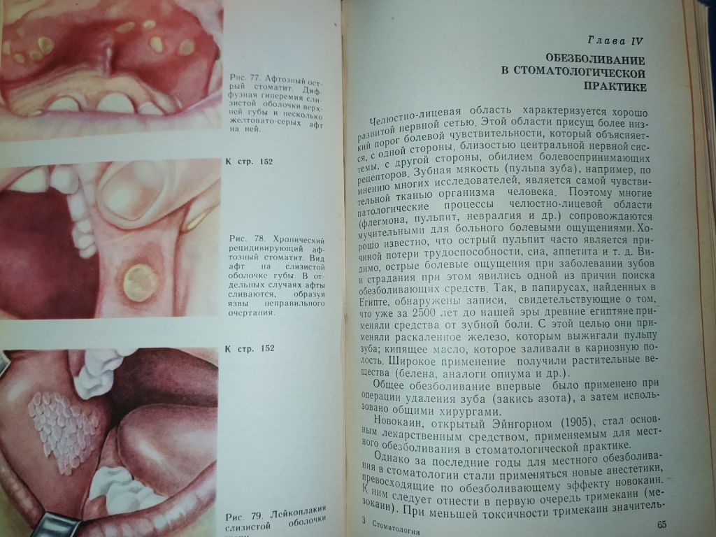 книга: СТОМАТОЛОГИЯ 1970г. - фото фото фото 13