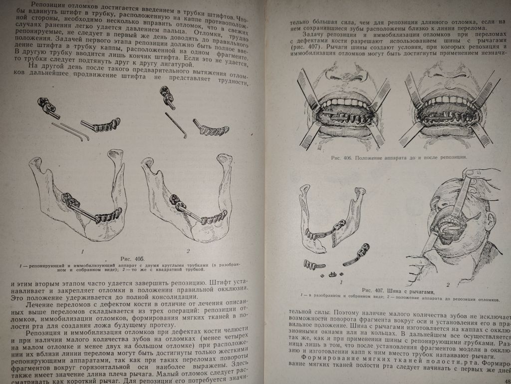 книга: УЧЕБНИК ОРТОПЕДИЧЕСКОЙ СТОМАТОЛОГИИ, II-е изд., 1962г. - фото фото фото 7