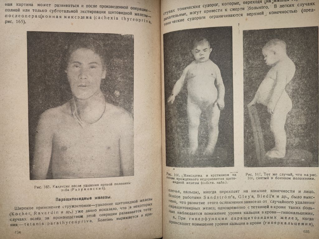 книга: ОСНОВЫ ОБЩЕЙ ХИРУРГИИ, том II, 1937г.; - фото фото фото 12