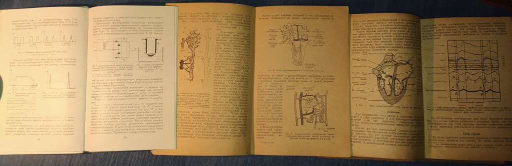 книги: ЭЛЕКТРОГИДРАВЛИЧЕСКАЯ ЦИСТОЛИТОТРИПСИЯ 1975г.; ФИЗИОЛОГИЯ ПОЧЕК 1949г.; ПОРОКИ СЕРДЦА 1932г.; - фото фото фото 3