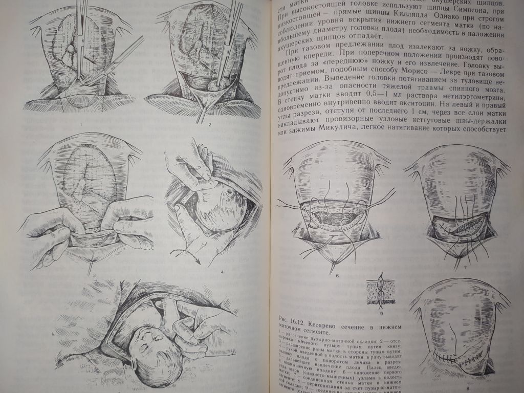 книга: ОПЕРАТИВНАЯ ГИНЕКОЛОГИЯ. Руководство для врачей 1990г. - фото фото фото 10