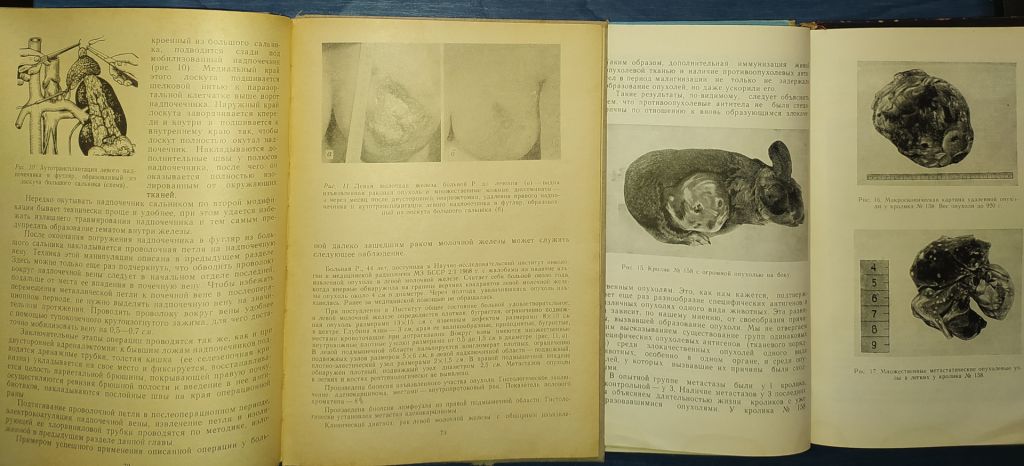книги: ОПЕРАЦИИ НА НАДПОЧЕЧНИКАХ. 1971г. ПРОФИЛАКТИКА, ДИАГНОСТИКА И ТЕРАПИЯ РАКА 1965г. - фото фото фото 6
