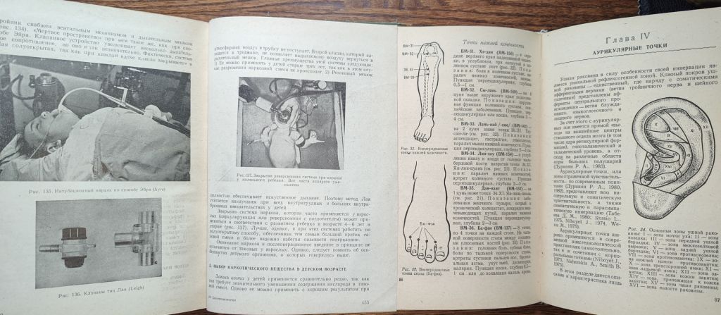 книги Анестезиолкниги: АНЕСТЕЗИОЛОГИЯ, III-e изд., 1963. ИГЛОТЕРАПИЯ В АНЕСТЕЗИОЛОГИИ И РЕАНИМАТОЛОГИИ 1985 - фото фото фото 6