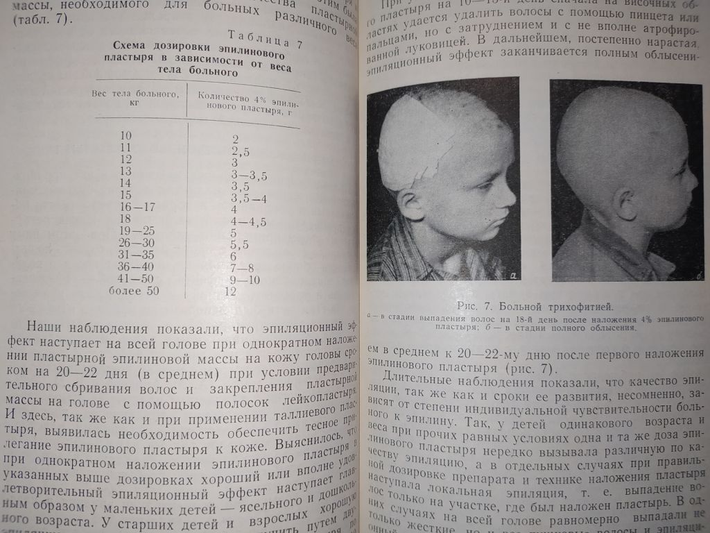 книга: ЭПИЛИН В ТЕРАПИИ ДЕРМАТОМИКОЗОВ ВОЛОСИСТОЙ ЧАСТИ ГОЛОВЫ 1961г. - фото фото фото 6