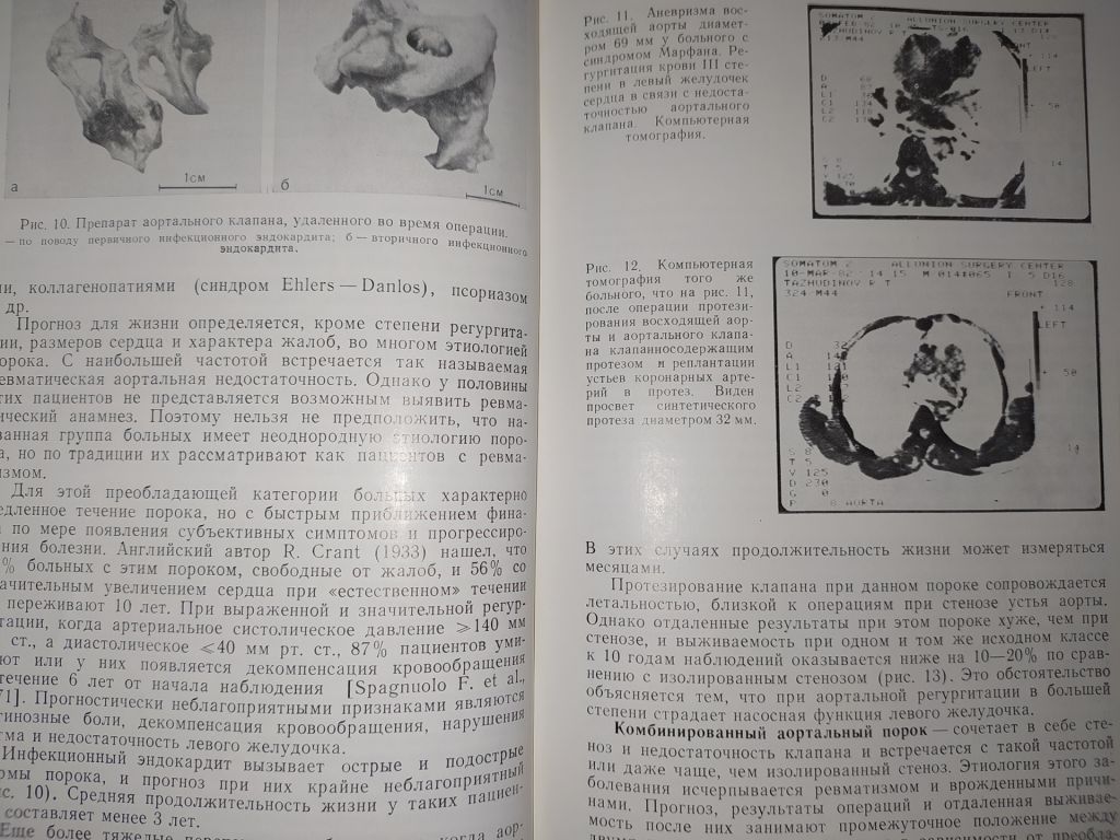 книга: БИОЛОГИЧЕСКИЕ ПРОТЕЗЫ КЛАПАНОВ СЕРДЦА 1988г. - фото фото фото 8