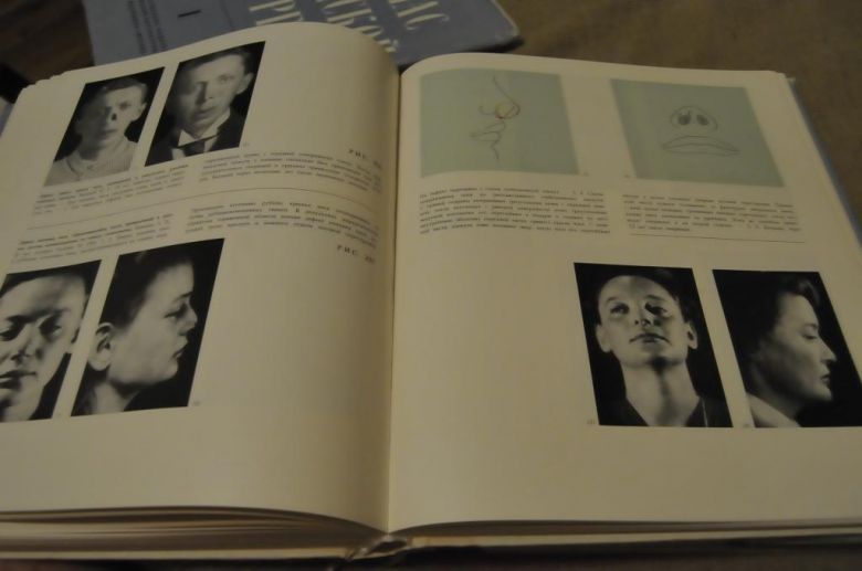 КНИГА АТЛАС ПЛАСТИЧЕСКОЙ ХИРУРГИИ 1967Г. 3 ТОМА - фото фото фото 3