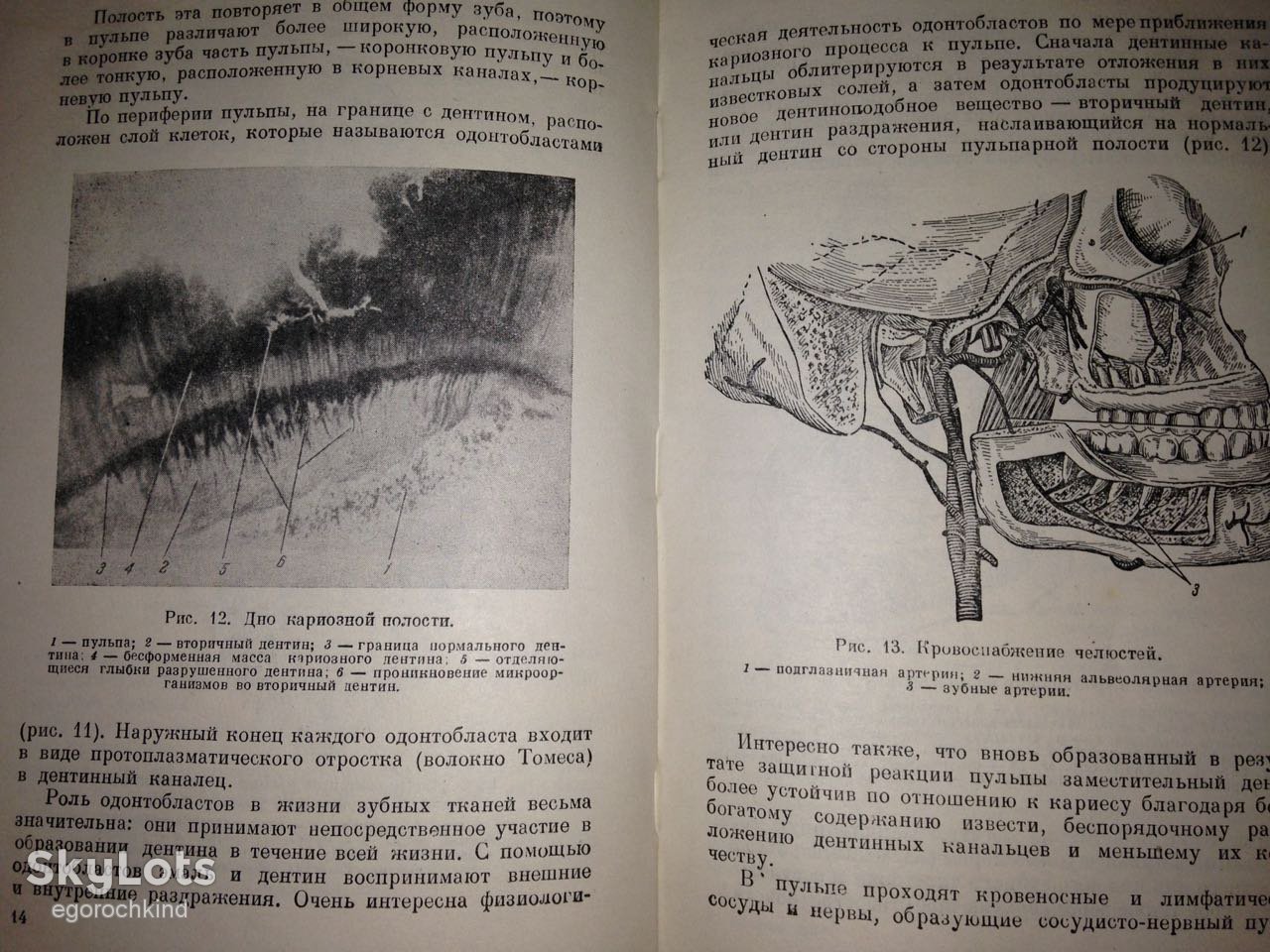 книга: БОЛЕЗНИ ЗУБОВ, ЧЕЛЮСТЕЙ И РТА 1949г. - фото фото фото 6