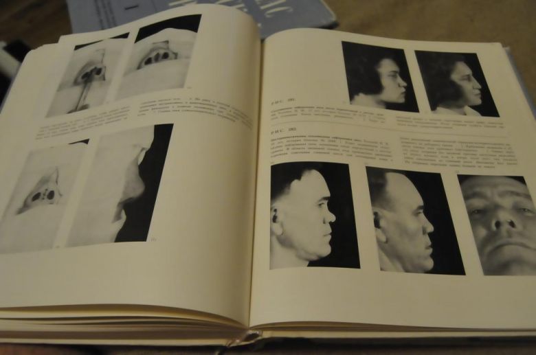 КНИГА АТЛАС ПЛАСТИЧЕСКОЙ ХИРУРГИИ 1967Г. 3 ТОМА - фото фото фото 5