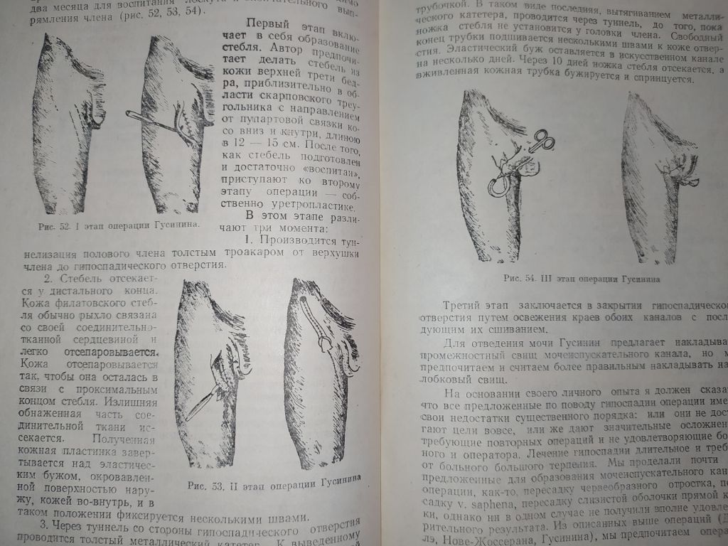 книга: ОЧЕРКИ ОПЕРАТИВНОЙ УРОЛОГИИ. II-e изд. 1959г. - фото фото фото 11