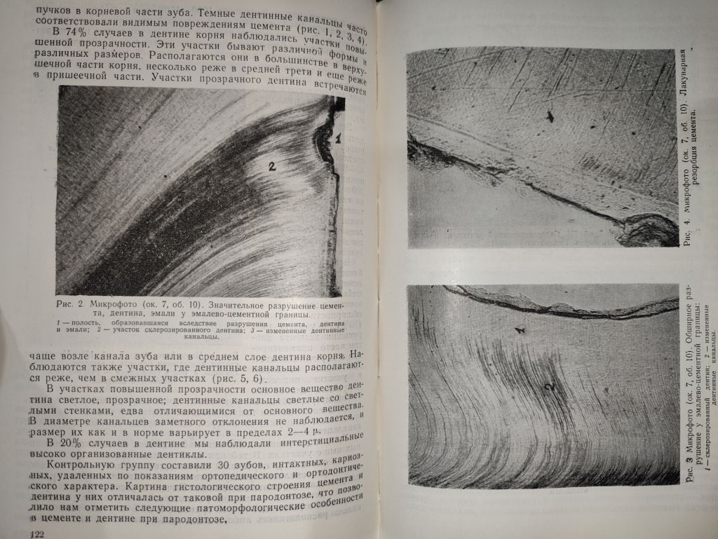 книга: ПРОБЛЕМЫ СТОМАТОЛОГИИ. ПАТОГЕНЕЗ, КЛИНИКА И ЛЕЧЕНИЕ ПАРОДОНТОЗА, том IV, 1958г. - фото фото фото 7