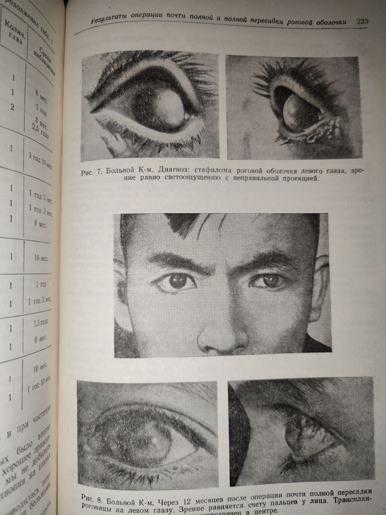 книга: ТКАНЕВАЯ ТЕРАПИЯ. БИОГЕННЫЕ СТИМУЛЯТОРЫ. ПЕРЕСАДКА РОГОВИЦЫ 1953г.; - фото фото фото 4