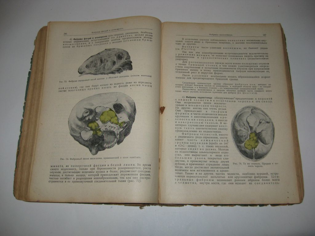 Общая хирургия Э. Лексер Lexer 2 том 1938 г. ? - фото фото фото 3
