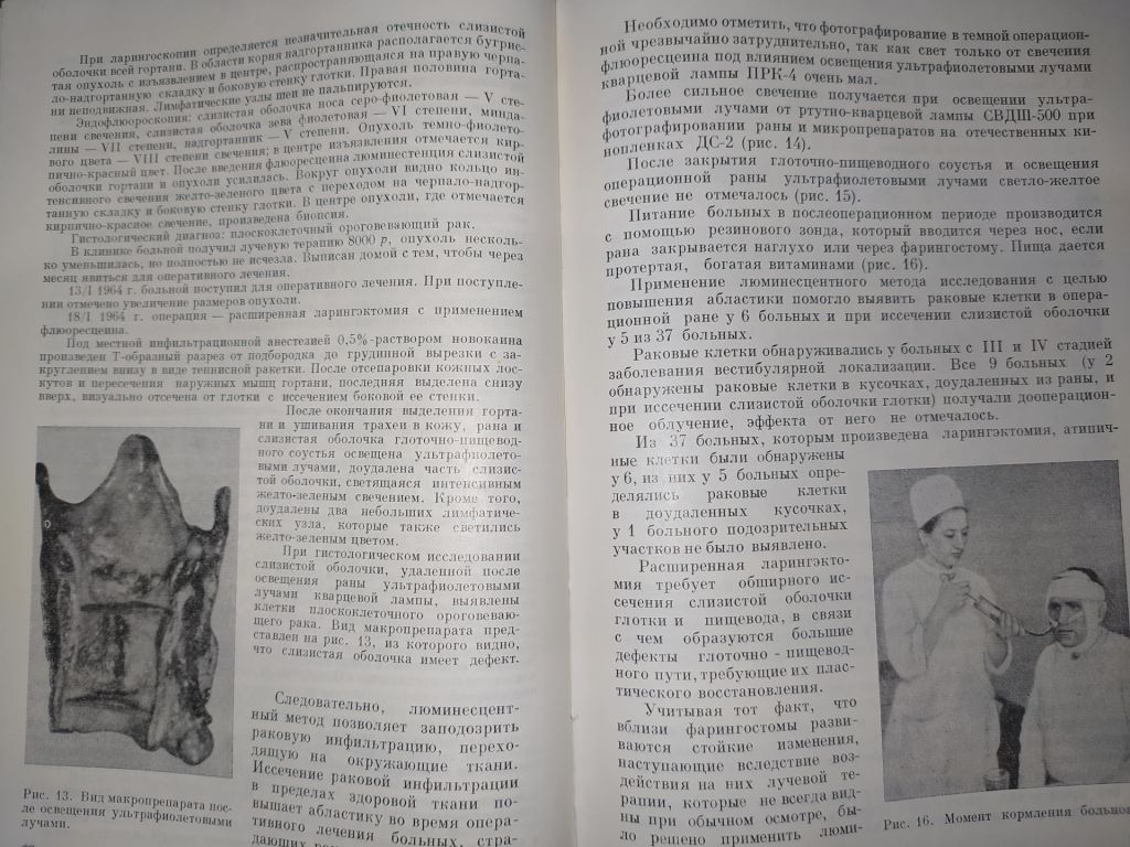 книга: ПУТИ ПОВЫШЕНИЯ АБЛАСТИКИ В ЛОРОНКОЛОГИИ 1969г. - фото фото фото 7