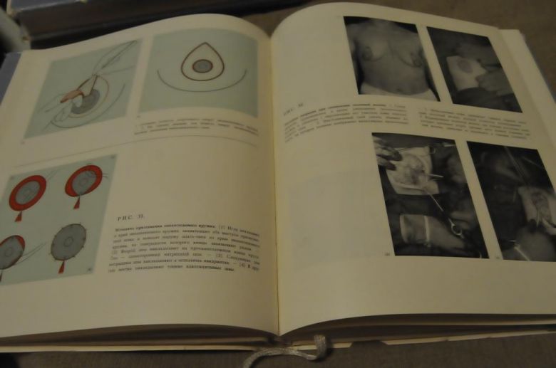 КНИГА АТЛАС ПЛАСТИЧЕСКОЙ ХИРУРГИИ 1967Г. 3 ТОМА - фото фото фото 6