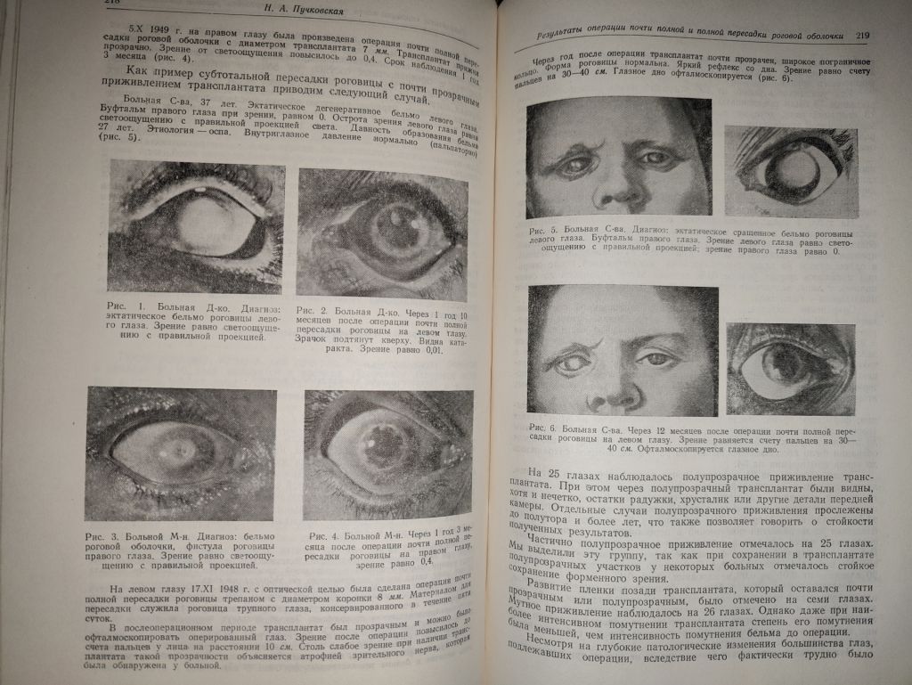 книга: ТКАНЕВАЯ ТЕРАПИЯ. БИОГЕННЫЕ СТИМУЛЯТОРЫ. ПЕРЕСАДКА РОГОВИЦЫ 1953г.; - фото фото фото 7