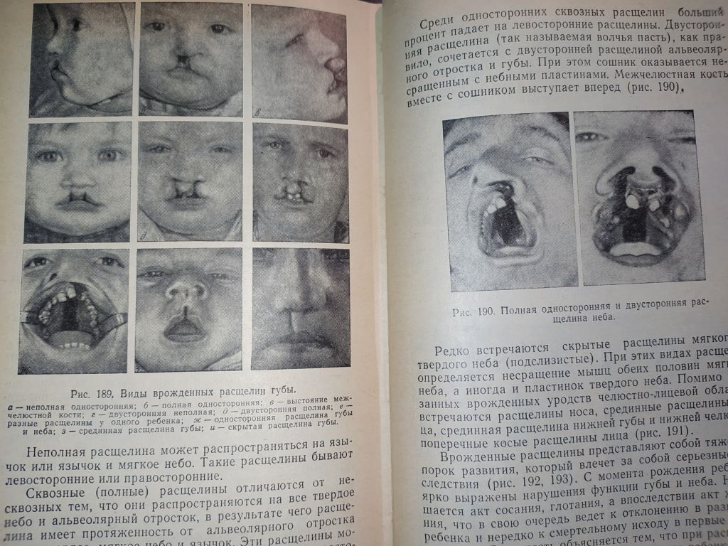 книга: СТОМАТОЛОГИЯ 1970г. - фото фото фото 7