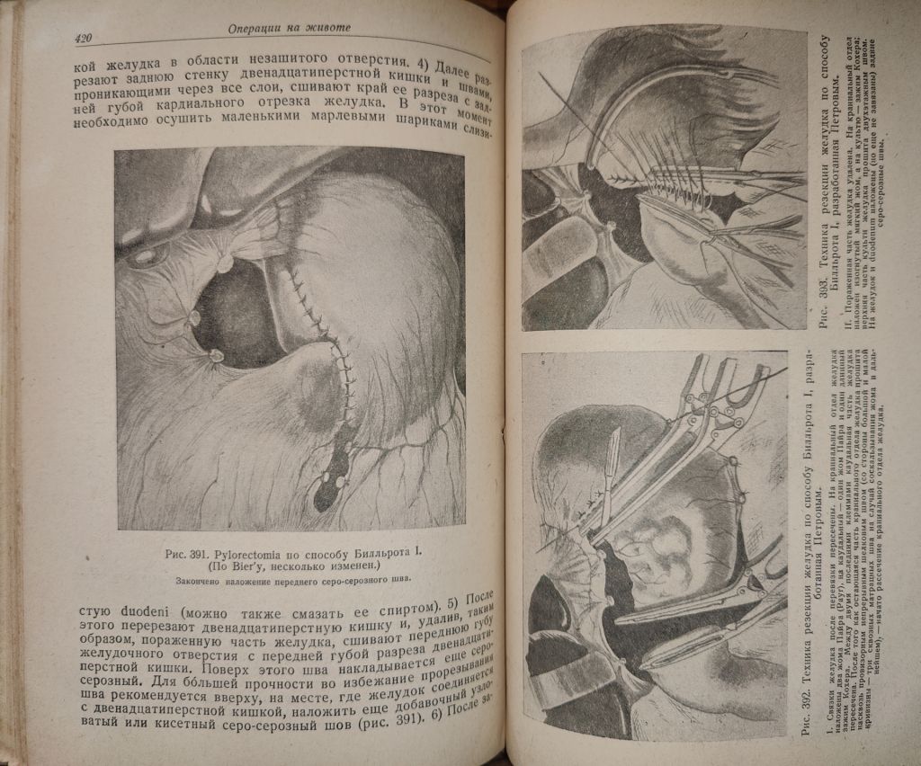 книга: КРАТКИЙ КУРС ОПЕРАТИВНОЙ ХИРУРГИИ 1938г.; - фото фото фото 12