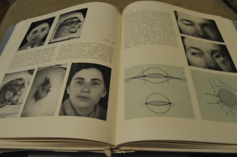 КНИГА АТЛАС ПЛАСТИЧЕСКОЙ ХИРУРГИИ 1967Г. 3 ТОМА - фото фото фото 7