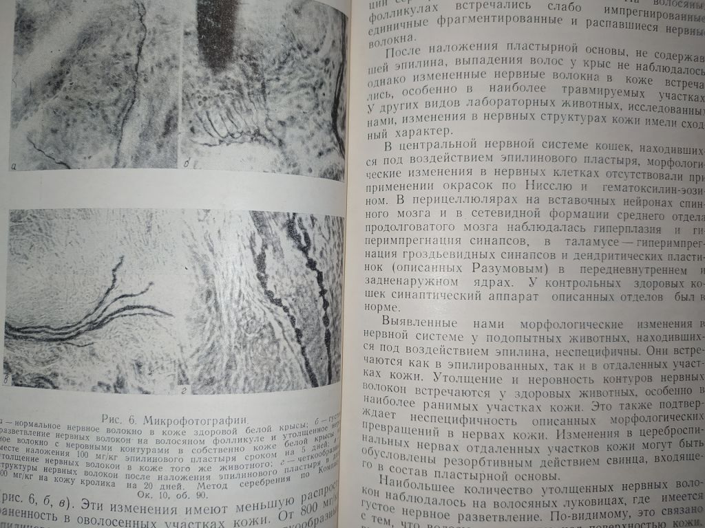 книга: ЭПИЛИН В ТЕРАПИИ ДЕРМАТОМИКОЗОВ ВОЛОСИСТОЙ ЧАСТИ ГОЛОВЫ 1961г. - фото фото фото 5