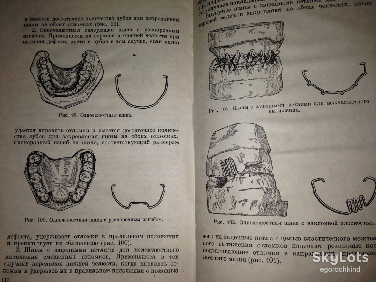 книга: БОЛЕЗНИ ЗУБОВ, ЧЕЛЮСТЕЙ И РТА 1949г. - фото фото фото 14