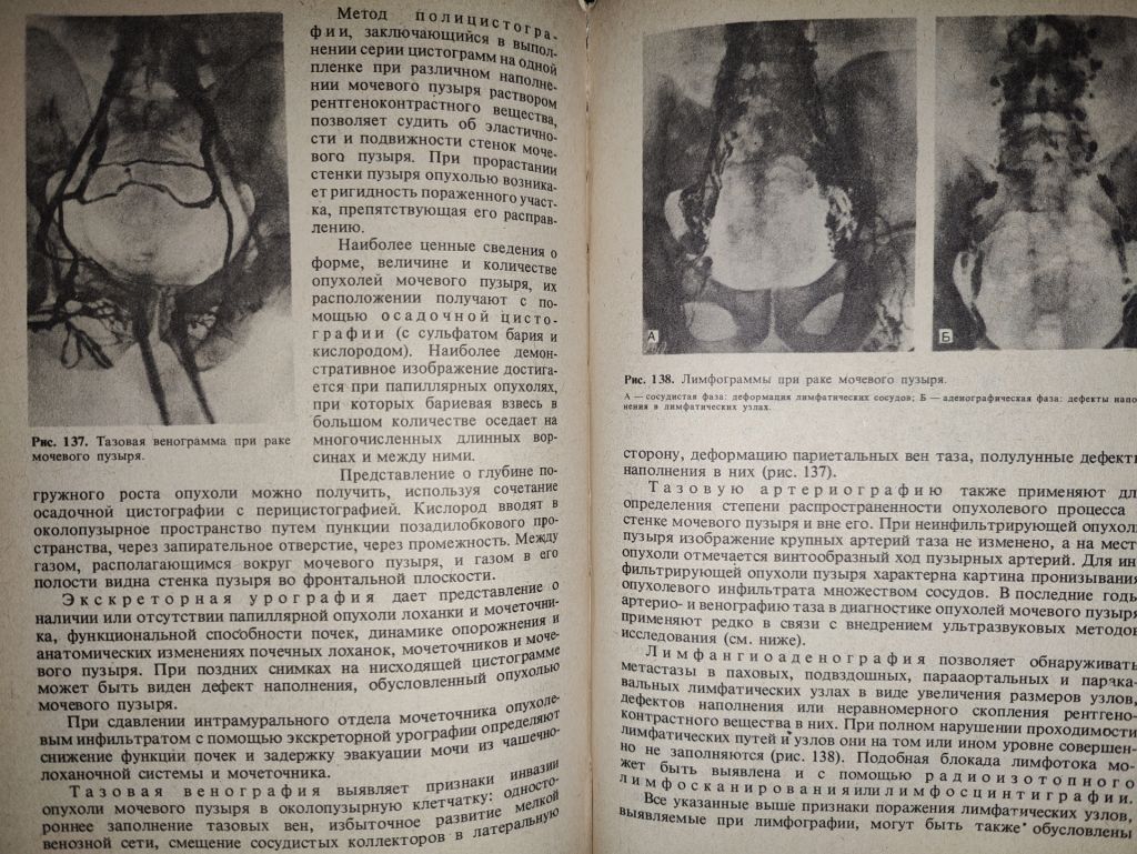 книга: УРОЛОГИЯ, II-е изд., 1982 - фото фото фото 4