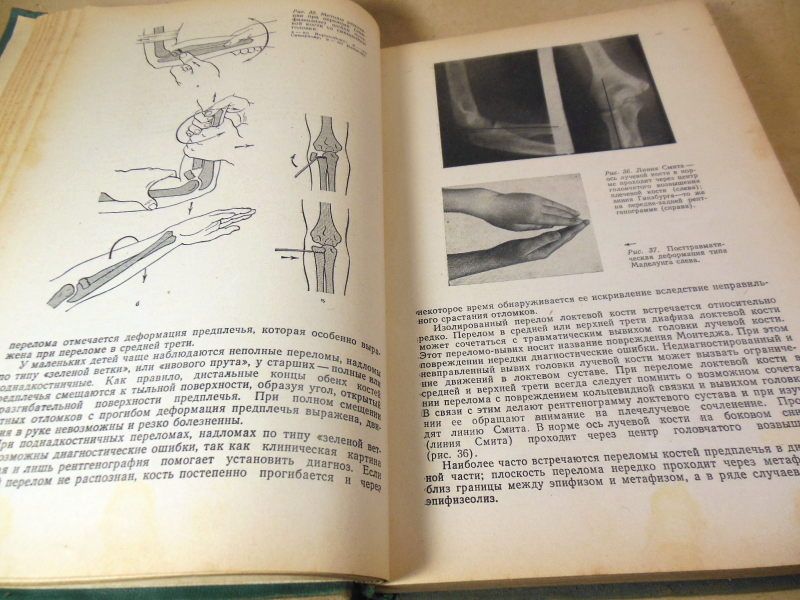 Ю.Ф.Исаков,С.Я.Долецкий. Детская хирургия - фото фото фото 2