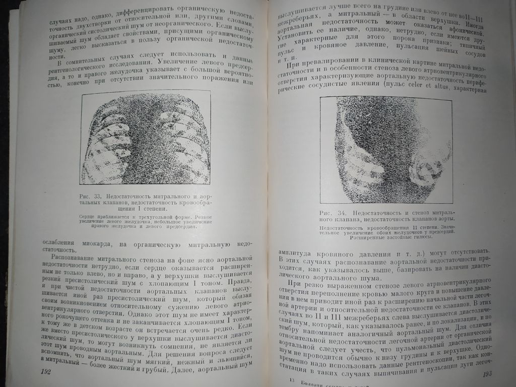 книга: БОЛЕЗНИ СЕРДЦА У ДЕТЕЙ. II-е изд. 1952г. - фото фото фото 7