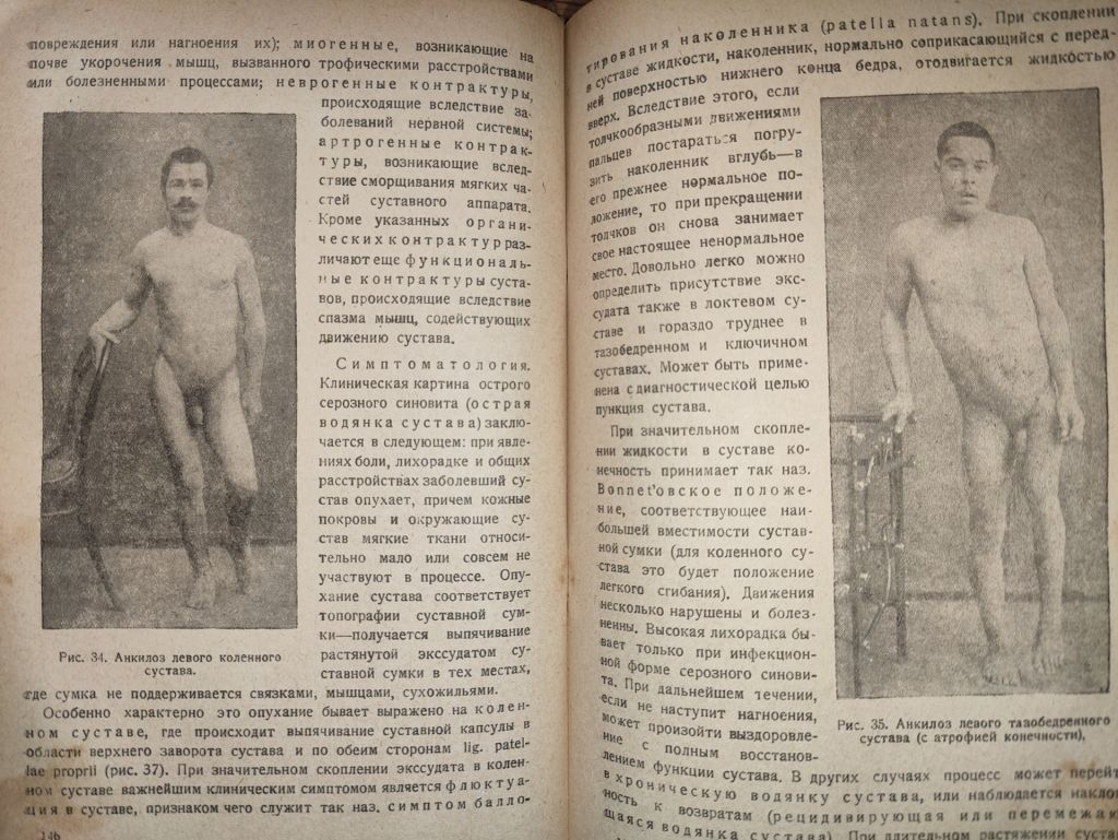 книга: ОСНОВЫ ОБЩЕЙ ХИРУРГИИ, том II, 1937г.; - фото фото фото 7