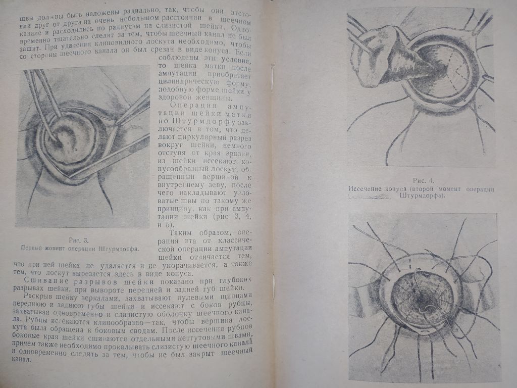 книга: ПРОФИЛАКТИКА, КЛИНИКА И ТЕРАПИЯ РАКА МАТКИ 1947г. - фото фото фото 4